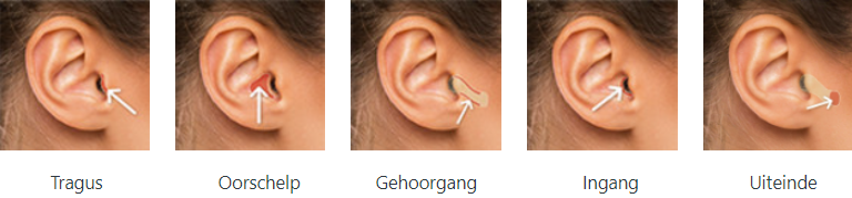 Custom Made Fitting Issue identification